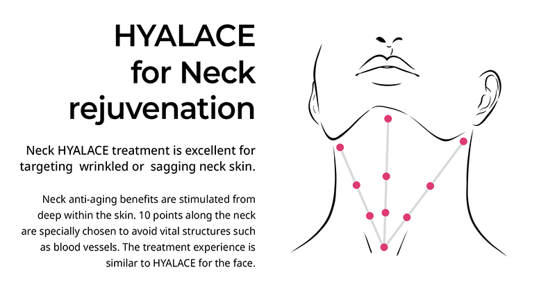 Hyalace Skin Booster, Hyalace for next rejuvenation